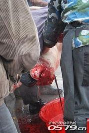 血的图片真实照片,血液的真实影像解析